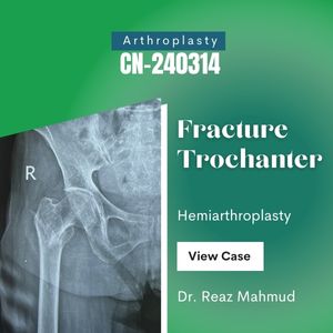 Hemiarthroplasty | Trochanter Fracture [CN-240314]