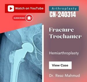 Hemiarthroplasty | Trochanter Fracture [CN-240314]