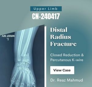 Distal Radius Fracture | Closed Reduction & Percutaneous K-wire [CN-240417]