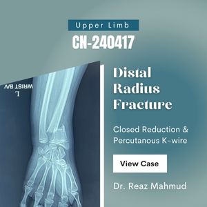 Distal Radius Fracture | Closed Reduction & Percutaneous K-wire [CN-240417]