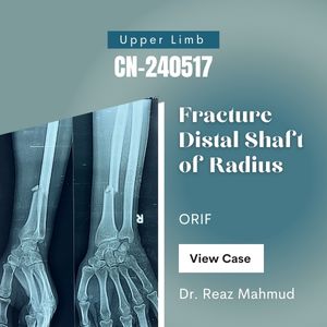 Shaft of Radius Fracture | ORIF c DCP